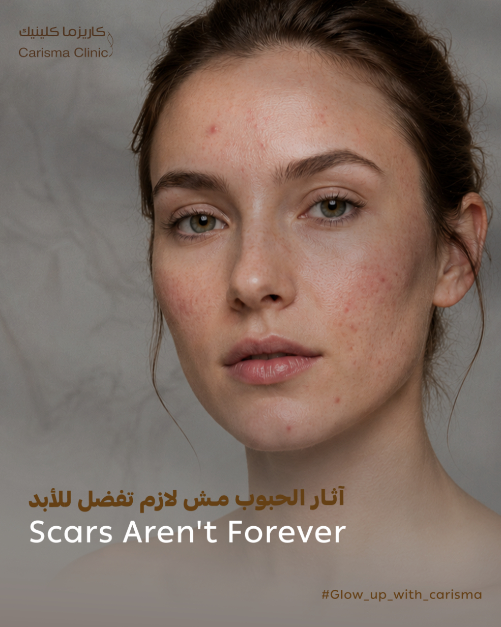 Acne and Scar Treatment
