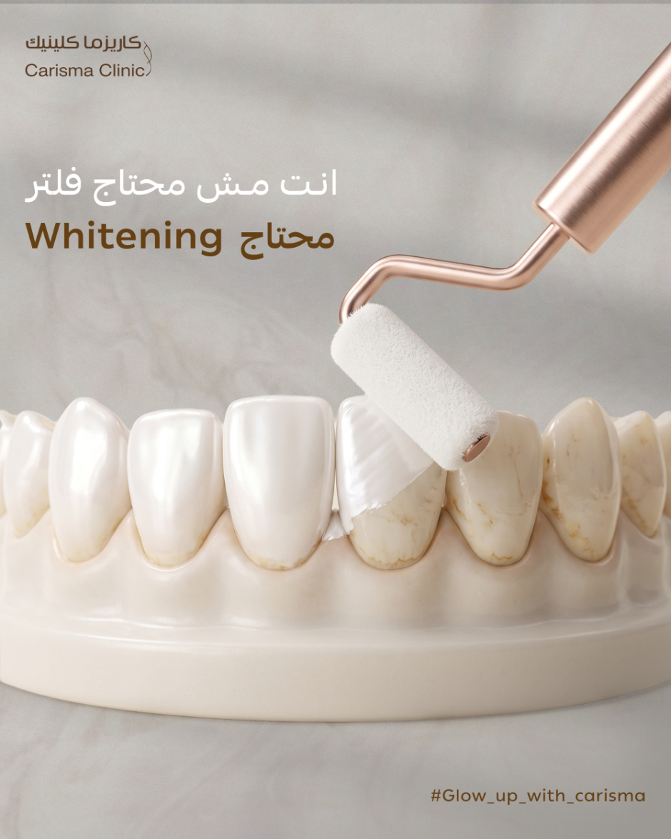Teeth Whitening