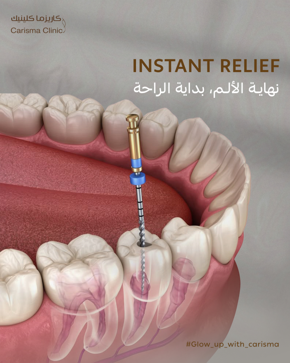 Dental Implants